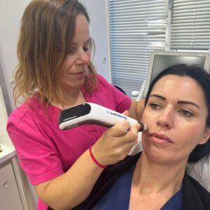 Dermapen aesthetic treatment is one of the services offered by Clinica Ocean in Marbella.